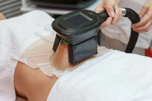 Image of person having fat freezing treatment to help weight gain Bury