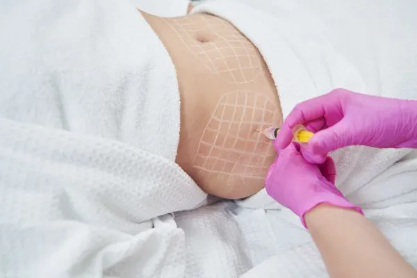 image of fat dissolving injections on love handles to help combat weight gain Bury