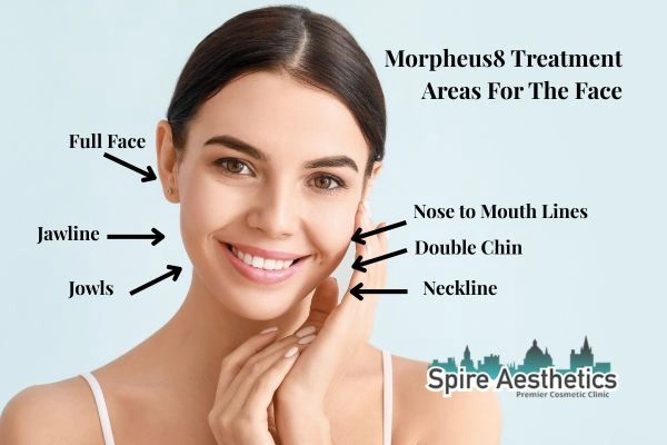 Where can Morpheus8 Treatment Bury be done on the body?