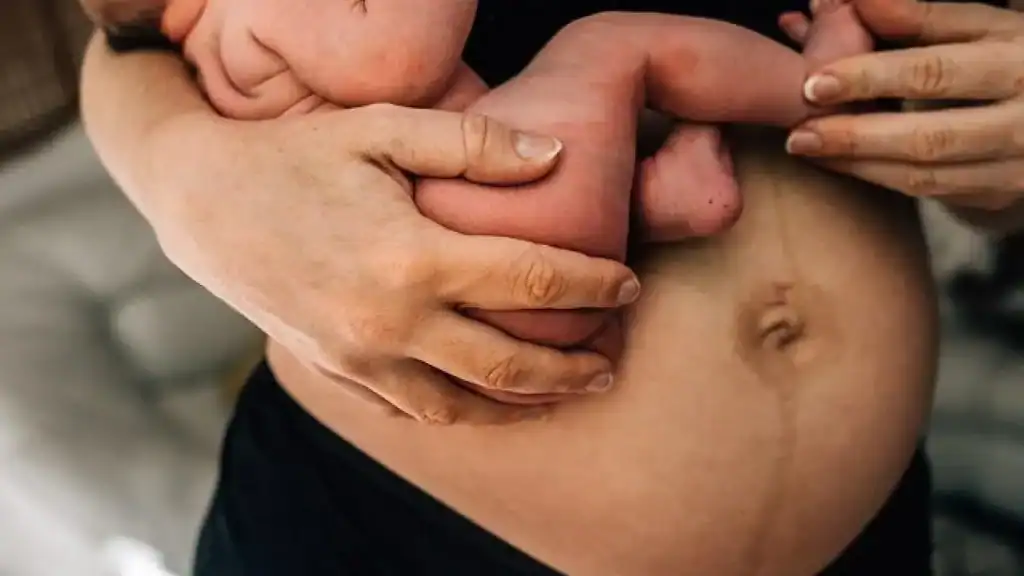 Why Is My Stomach Still Big After Pregnancy Bury?